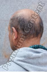 Head Hair Man White Casual Overweight Bald Street photo references